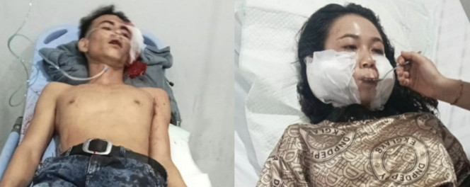 Viral Abang-adik Dibegal di Marelan, Ternyata Ditikam